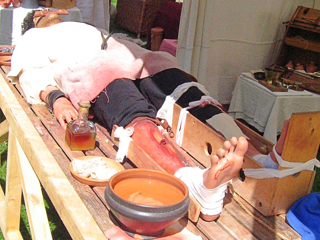 The Operating Table of a Roman Doctor © essentially-england.com